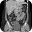 CT Abdomen Pelvis